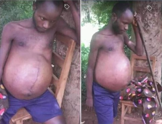 Man Heavily Pregnant In 2 Days After Sleeping With Someone’s Wife