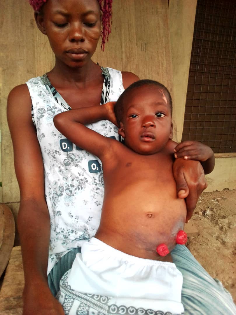 PARENTS ARE CALLING FOR 170 MILLION OLD GHANA CEDIS SUPPORT TO SAVE STEPHANIE APPIAH AN AMBIGUOUS JENITYLIA PATIENT.