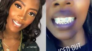 Tiwa Savage customises her teeth