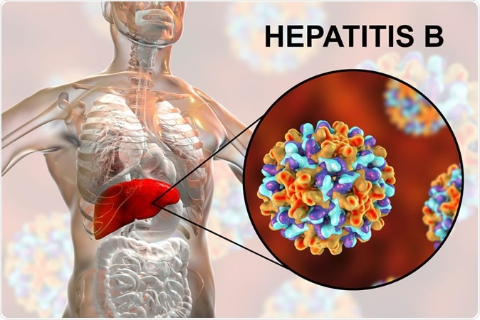 BREAKING: HEPATITIS B/C; IT KILLS THAN HIV/AIDS; VERY EASY TREATMENT AVAILABLE HERE -CHECK OUT